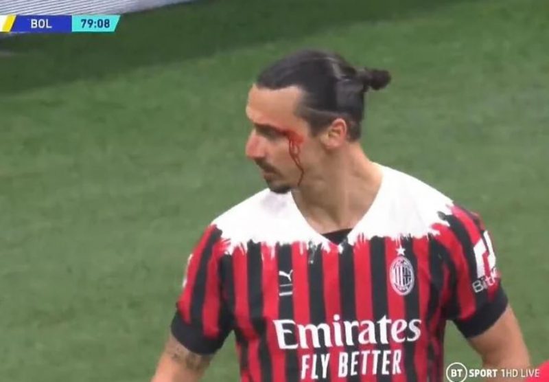 Popularni švedski napadač Zlatan Ibrahimović završio krvave glave nakon jako žestokog sudara sa Medelom